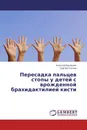 Пересадка пальцев стопы у детей с врожденной брахидактилией кисти - Алексей Балашов, Сергей Голяна