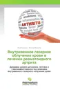 Внутривенное лазерное облучение крови в лечении ревматоидного артрита - Нина Бурдули, Николай Бурдули