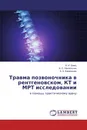 Травма позвоночника в рентгеновском, КТ и МРТ исследовании - А. И. Швец,А. С. Нехлопочин, А. А. Баранишин