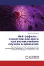 Нейтрофилы - спасители или враги при возникновении опухоли в организме - Валентина Мальцева