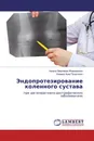 Эндопротезирование коленного сустава - Азизов Мирхаким Жавхарович, Алимов Азиз Пулатович
