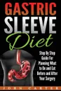 Gastric Sleeve Diet. Step By Step Guide For Planning What to Do and Eat Before and After Your Surgery - John Carter
