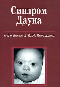 Обложка книги Синдром Дауна, Под редакцией Ю. И. Барашнева