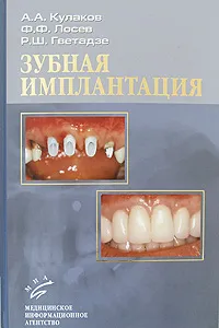 Обложка книги Зубная имплантация, А. А. Кулаков, Ф. Ф. Лосев, Р. Ш. Гветадзе