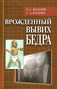 Обложка книги Врожденный вывих бедра, О. А. Малахов, С. Э. Кралина