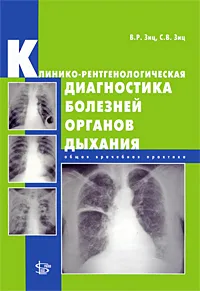 Обложка книги Клинико-рентгенологическая диагностика болезней органов дыхания. Общая врачебная практика, В. Р. Зиц, С. В. Зиц