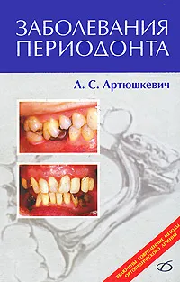 Обложка книги Заболевания периодонта, А. С. Артюшкевич