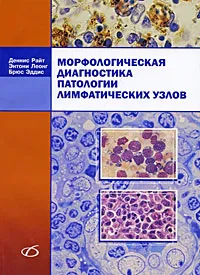 Обложка книги Морфологическая диагностика патологии лимфатических узлов, Деннис Райт, Энтони Леонг, Брюс Эддис