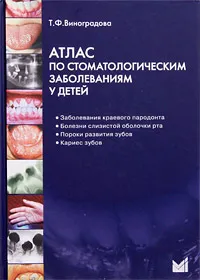 Обложка книги Атлас по стоматологическим заболеваниям у детей (+ CD-ROM), Т. Ф. Виноградова