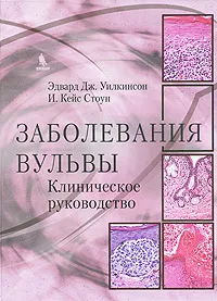 Обложка книги Заболевания вульвы. Клиническое руководство, Эдвард Дж. Уилкинсон, И. Кейс Стоун