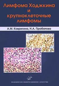 Обложка книги Лимфома Ходжкина и крупноклеточные лимфомы, А. М. Ковригина, Н. А. Пробатова