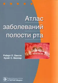 Обложка книги Атлас заболеваний полости рта, Роберт П. Лангле, Крэйг С. Миллер