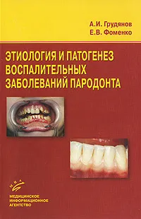 Обложка книги Этиология и патогенез воспалительных заболеваний пародонта, А. И. Грудянов, Е. В. Фоменко