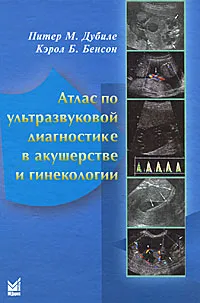 Обложка книги Атлас по ультразвуковой диагностике в акушерстве и гинекологии, Питер М. Дубиле, Кэрол Б. Бенсон