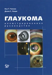 Обложка книги Глаукома. Иллюстрированное руководство, Нил Т. Чоплин, Диана С. Ланди