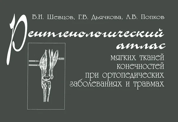 Обложка книги Рентгенологический атлас мягких тканей конечностей при ортопедических заболеваниях и травмах, В. И. Шевцов, Г. В. Дьячкова, А. В. Попков