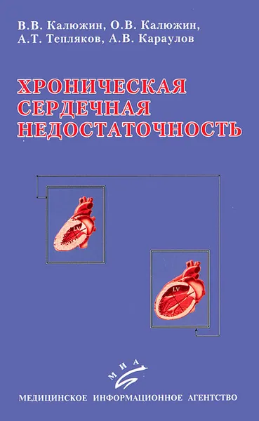 Обложка книги Хроническая сердечная недостаточность, В. В. Калюжин, О. В. Калюжин, А. Т. Тепляков, А. В. Караулов