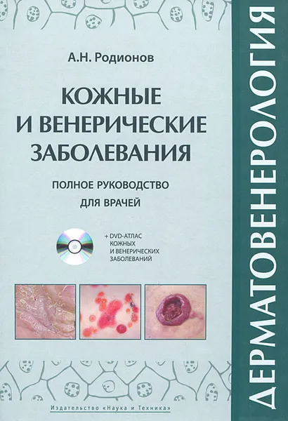 Обложка книги Дерматовенерология. Полное руководство для врачей (+ DVD-ROM), А. Н. Родионов