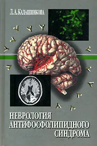 Обложка книги Неврология антифосфолипидного синдрома, Калашникова Людмила Андреевна