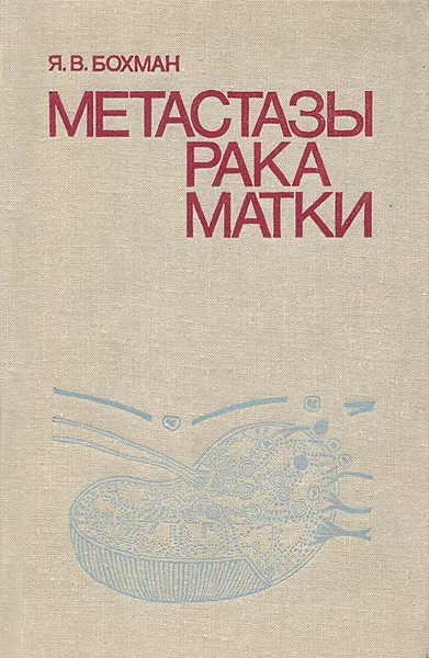 Обложка книги Метастазы рака матки, Я. В. Бохман