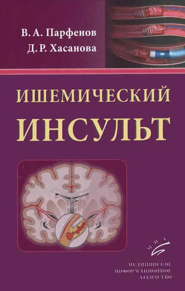 Обложка книги Ишемический инсульт, В. А. Парфенов, Д. Р. Хасанова