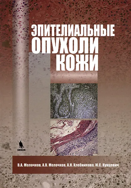 Обложка книги Эпителиальные опухоли кожи, В. А. Молочков, А. В. Молочков, А. Н. Хлебникова, Ж. С. Кунцевич