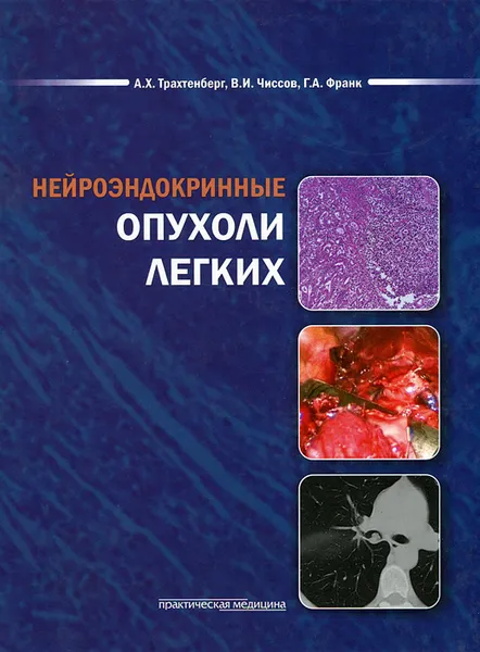 Обложка книги Нейроэндокринные опухоли легких, А. Х. Трахтенберг, В. И. Чиссов, Г. А. Франк