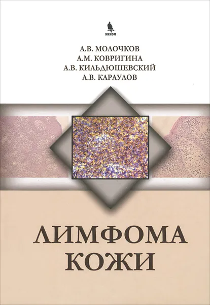 Обложка книги Лимфома кожи, А. В. Молочков, А. М. Ковригина, А. В. Кильдюшевский, А. В. Караулов