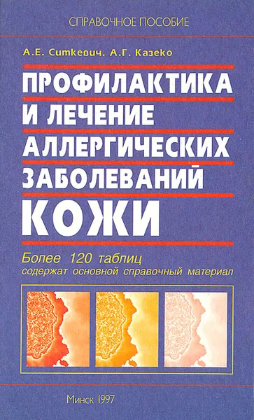 Обложка книги Профилактика и лечение аллергических заболеваний кожи, А. Е. Ситкевич, А. Г. Казеко