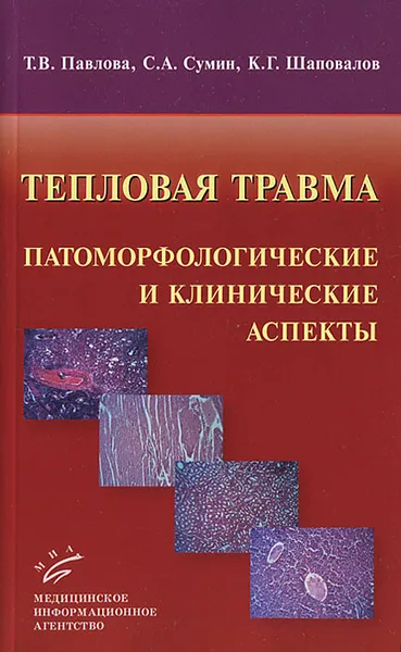 Обложка книги Тепловая травма. Патоморфологические и и клинические аспекты, Т. В. Павлова, С. А. Сумин, К. Г. Шаповалов