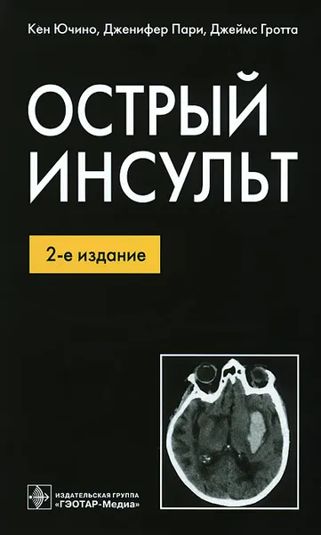 Обложка книги Острый инсульт, Кен Ючино, Дженифер Пари, Джеймс Гротта