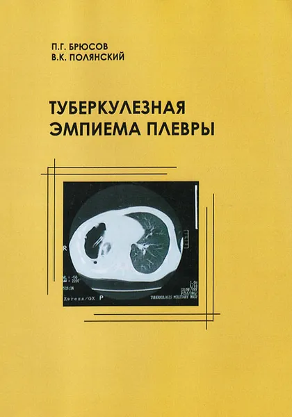 Обложка книги Туберкулезная эмпиема плевры, П. Г. Брюсов, В. К. Полянский