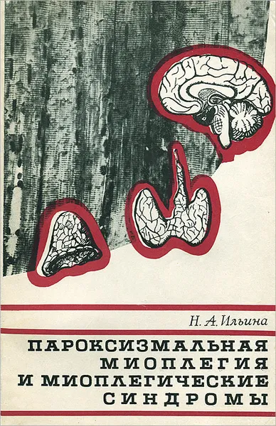 Обложка книги Пароксизмальная миоплегия и миоплегические синдромы, Ильина Наталия Андреевна