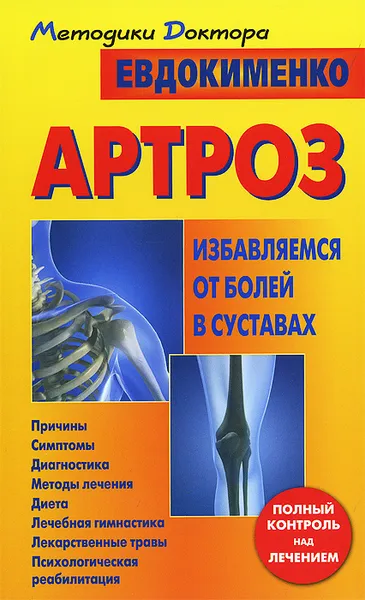 Обложка книги Артроз. Избавляемся от болей в суставах, П. В. Евдокименко