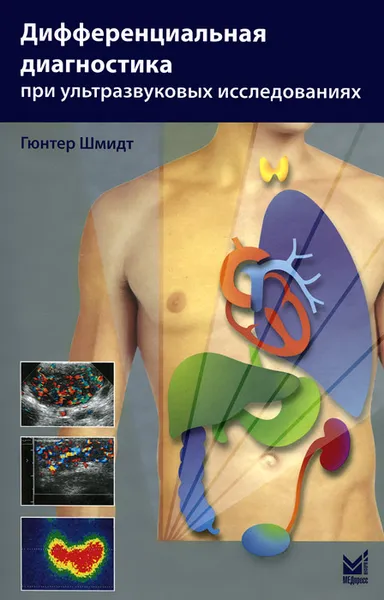 Обложка книги Дифференциальная диагностика при ультразвуковых исследованиях, Гюнтер Шмидт