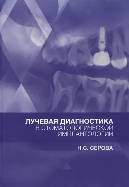 Обложка книги Лучевая диагностика в стоматологической имплантологии, Серова Наталья Сергеевна