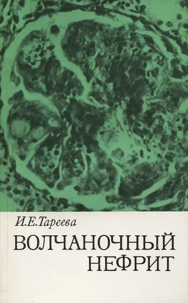 Обложка книги Волчаночный нефрит, И. Е. Тареева