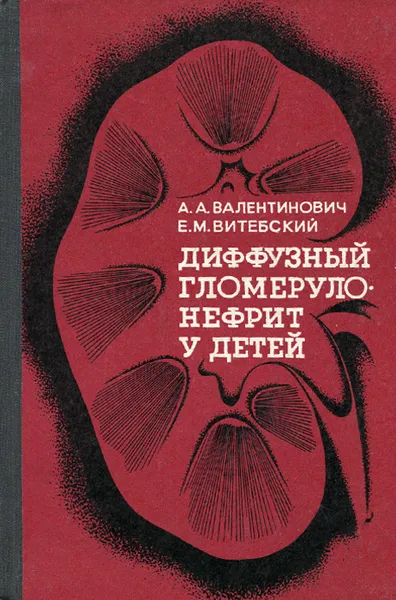 Обложка книги Диффузный гломерулонефрит у детей, А. А. Валентинович, Е. М. Витебский