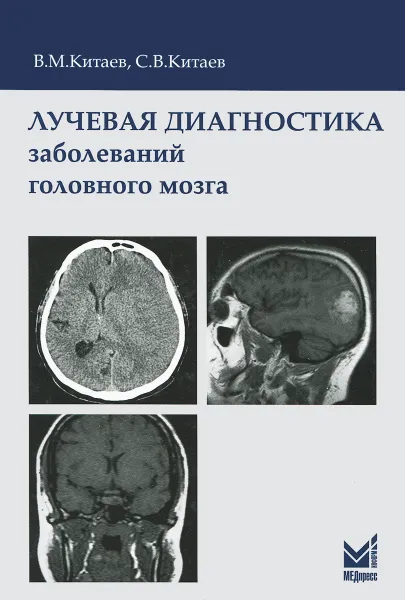 Обложка книги Лучевая диагностика заболеваний головного мозга, В. М. Китаев, С. В. Китаев