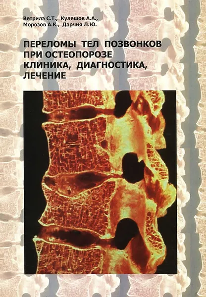 Обложка книги Переломы тел позвонков при остеопорозе. Клиника, диагностика, лечение, С. Т. Ветрилэ, А. А. Кулешов, А. К. Морозов, Л. Ю. Дарчия