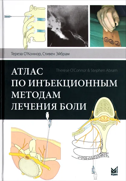 Обложка книги Атлас по инъекционным методам лечения боли, Тереза О'Коннор, Стивен Эйбрам