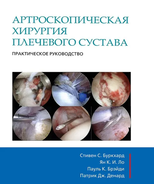 Обложка книги Артроскопическая хирургия плечевого сустава. Практическое руководство, Стивен С. Буркхард, Ян К. И. Ло, Пауль К. Брэйди, Патрик Дж. Денард