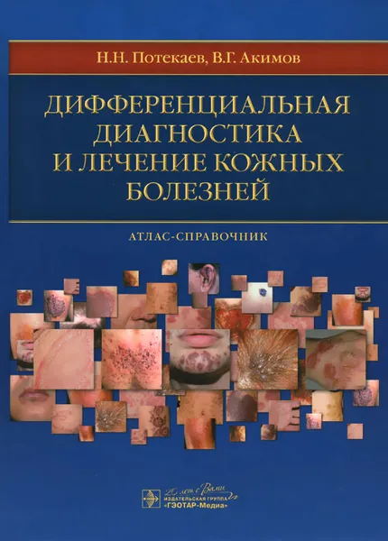 Обложка книги Дифференциальная диагностика и лечение кожных болезней, Н. Н. Потекаев, В. Г. Акимов