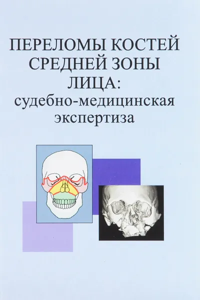 Обложка книги Переломы костей средней зоны лица. Судебно-медицинская экспертиза. Пособие, Н. Саврасова,Людмила Гришенкова,Е. Меркулова,Владимир Кузьмичев,Федор Горбачев,Светлана Анищенко