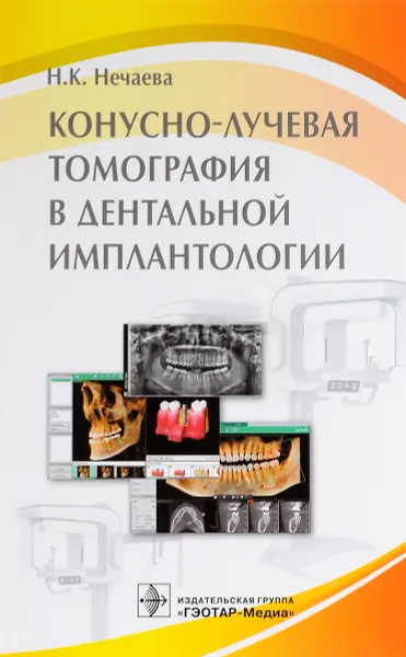 Обложка книги Конусно-лучевая томография в дентальной имплантологии, Н. К. Нечаева