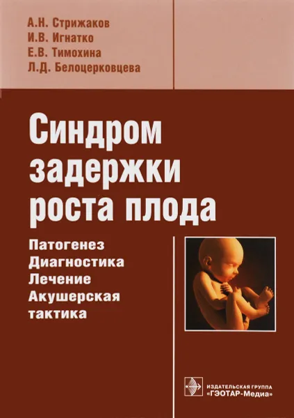 Обложка книги Синдром задержки роста плода. Патогенез, диагностика, лечение, акушерская тактика, А. Н. Стрижаков, И. В. Игнатко, Е. В. Тимохина, Л. Д. Белоцерковцева