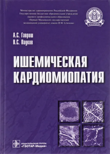 Обложка книги Ишемическая кардиомиопатия, А. С. Гавриш, В. С. Пауков