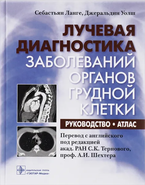 Обложка книги Лучевая диагностика заболеваний органов грудной клетки. Руководство. Атлас, Себастьян Ланге, Джеральдин Уолш