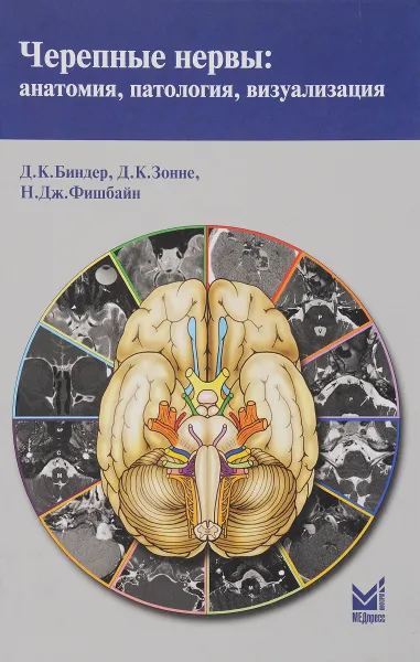 Обложка книги Черепные нервы. Анатомия, патология, визуализация, Д. К. Биндер, Д. К. Зонне, Н. Дж. Фишбайн