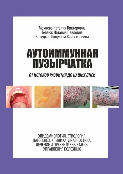 Обложка книги Аутоиммунная пузырчатка. От истоков развития до наших дней, Махнева Наталия Викторовна, Теплюк Наталия Павловна, Белецкая Людмила Вячеславовна